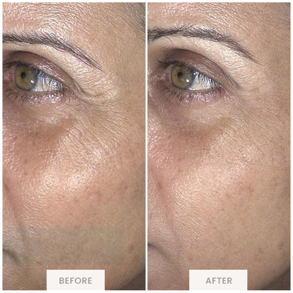 TriPollar ENVIG EDGE. Facial care devices