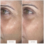 ENVIG EDGE. Facial care devices