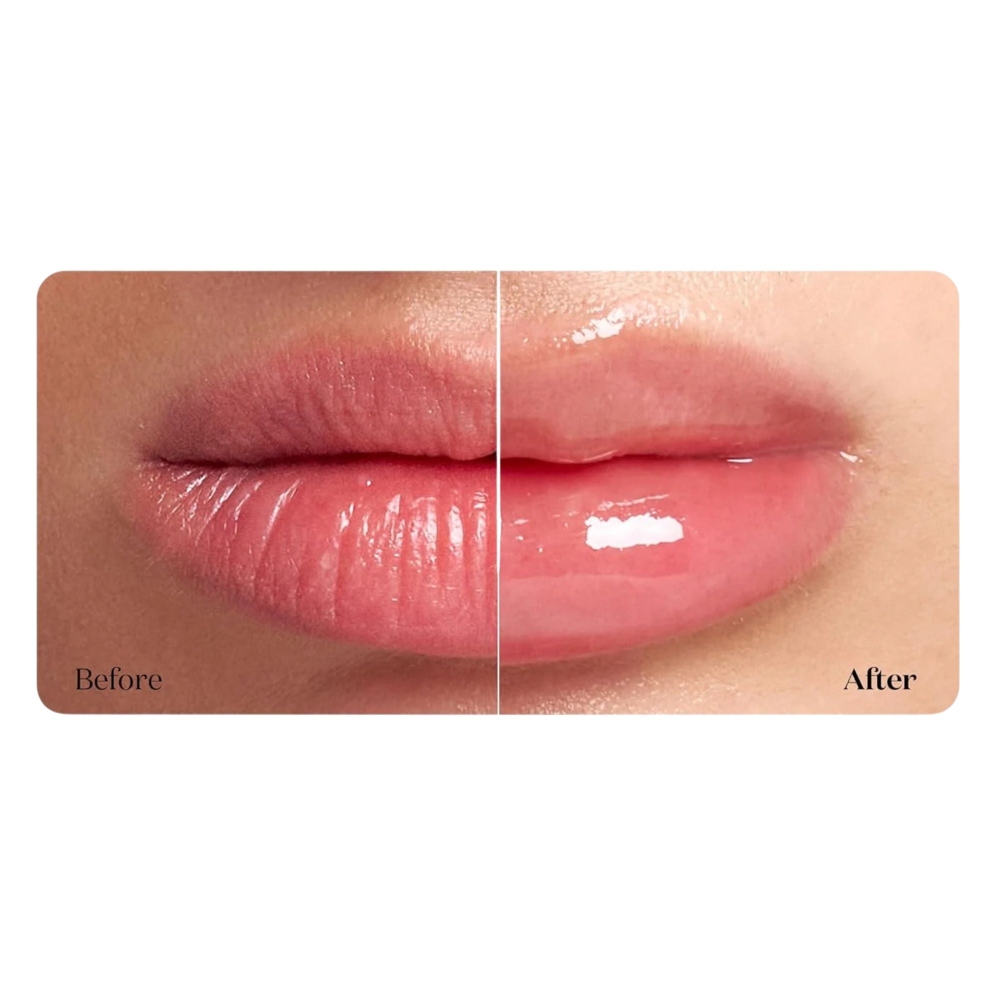 VT Cosmetics "Reedle Shot Lip Plumper Beginner" lūpų putlintojas. Korėjietiška lūpų priežiūra