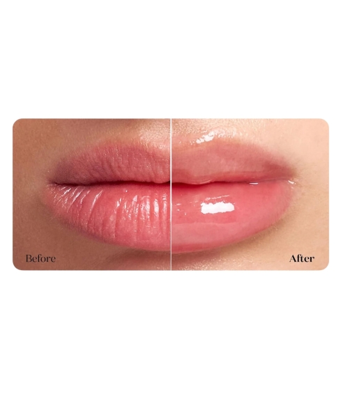 Reedle Shot Lip Plumper Beginner. Korean Lip Care